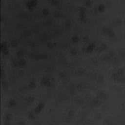 Median image of from film of Chlamydomonas cells